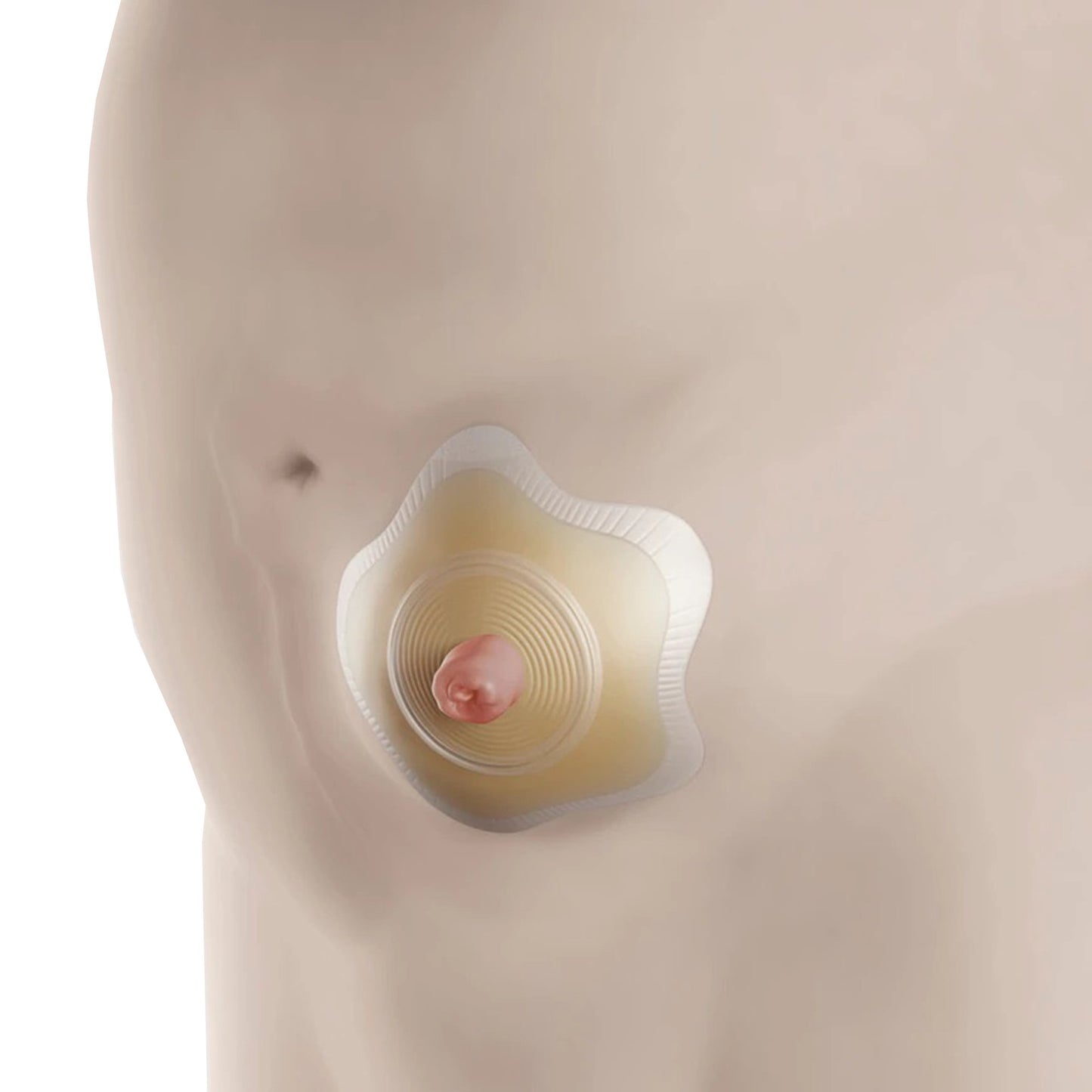 SenSura® Mio Click Convex Flip Ostomy Barrier, 35 mm Stomas, Red Match 18513