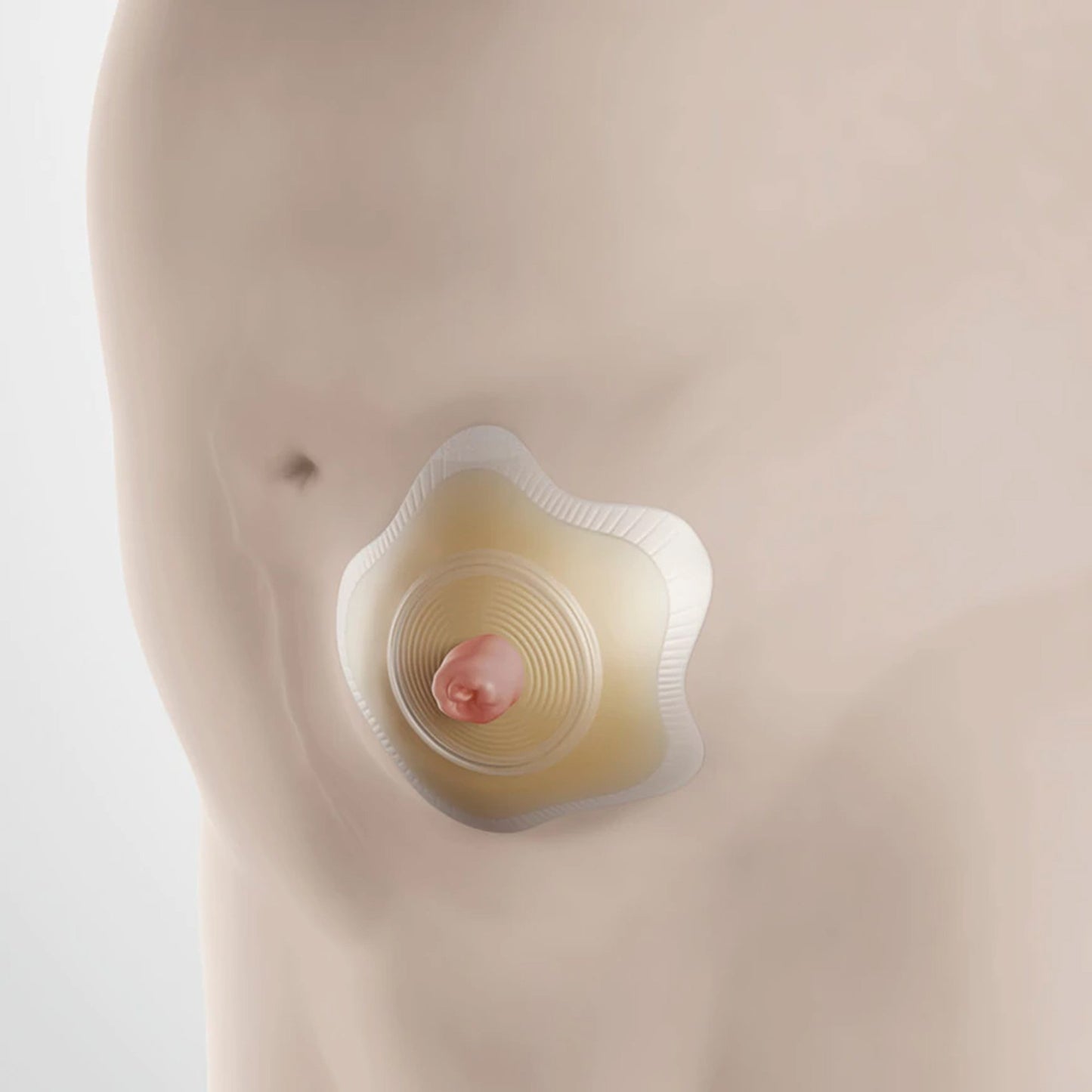 SenSura® Mio Convex Flip Ostomy Barrier, 30 mm Stoma Opening, Red Match 18512