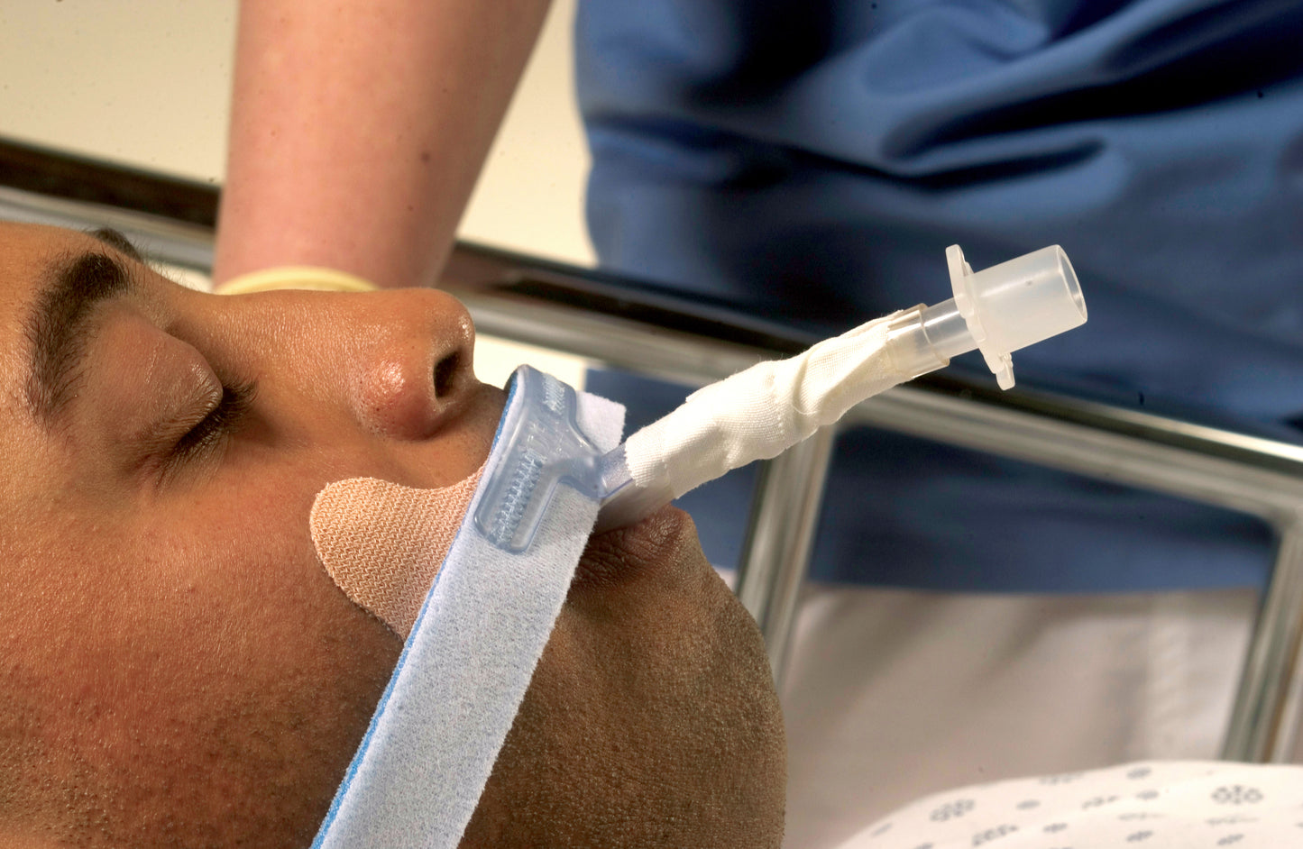 Stabilock™ Endotracheal Tube Holder 270