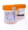 Specimen Container Starplex® StarCLICK 100 66 mm Height 100 mL (3.4 oz.) Screw Cap Patient Information Sterile B1002-OCCTS