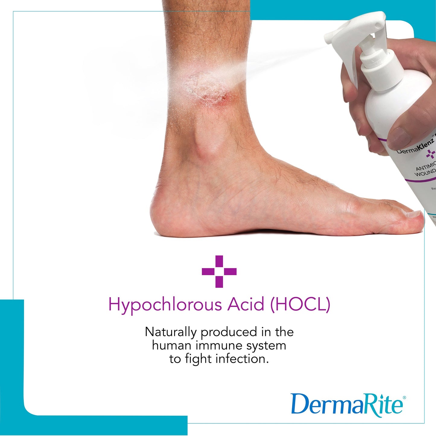 DermaRite's DermaKlenz PLUS Wound Cleanser - Spray Bottle, 8 oz. 00257