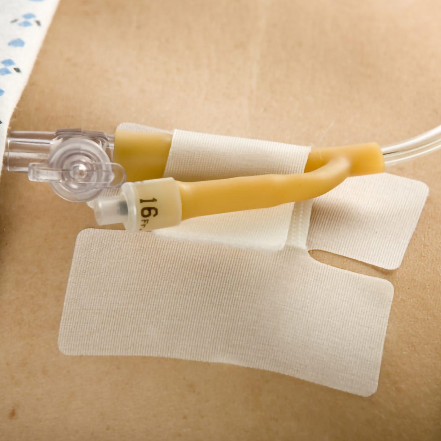 Cath Secure® Extended Tab Tube Holder 5445-3