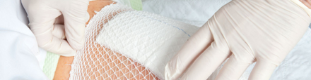 Advanced Wound Care