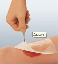Oil Emulsion Impregnated Dressing Cuticerin Rectangle 8 X 16 Inch Sterile - 66045502