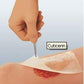 Oil Emulsion Impregnated Dressing Cuticerin Rectangle 8 X 16 Inch Sterile - 66045502