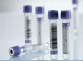 VACUETTE® Venous Blood Collection Tube K3 EDTA Additive 3 mL Pull Cap Polyethylene Terephthalate (PET) Tube - 454217