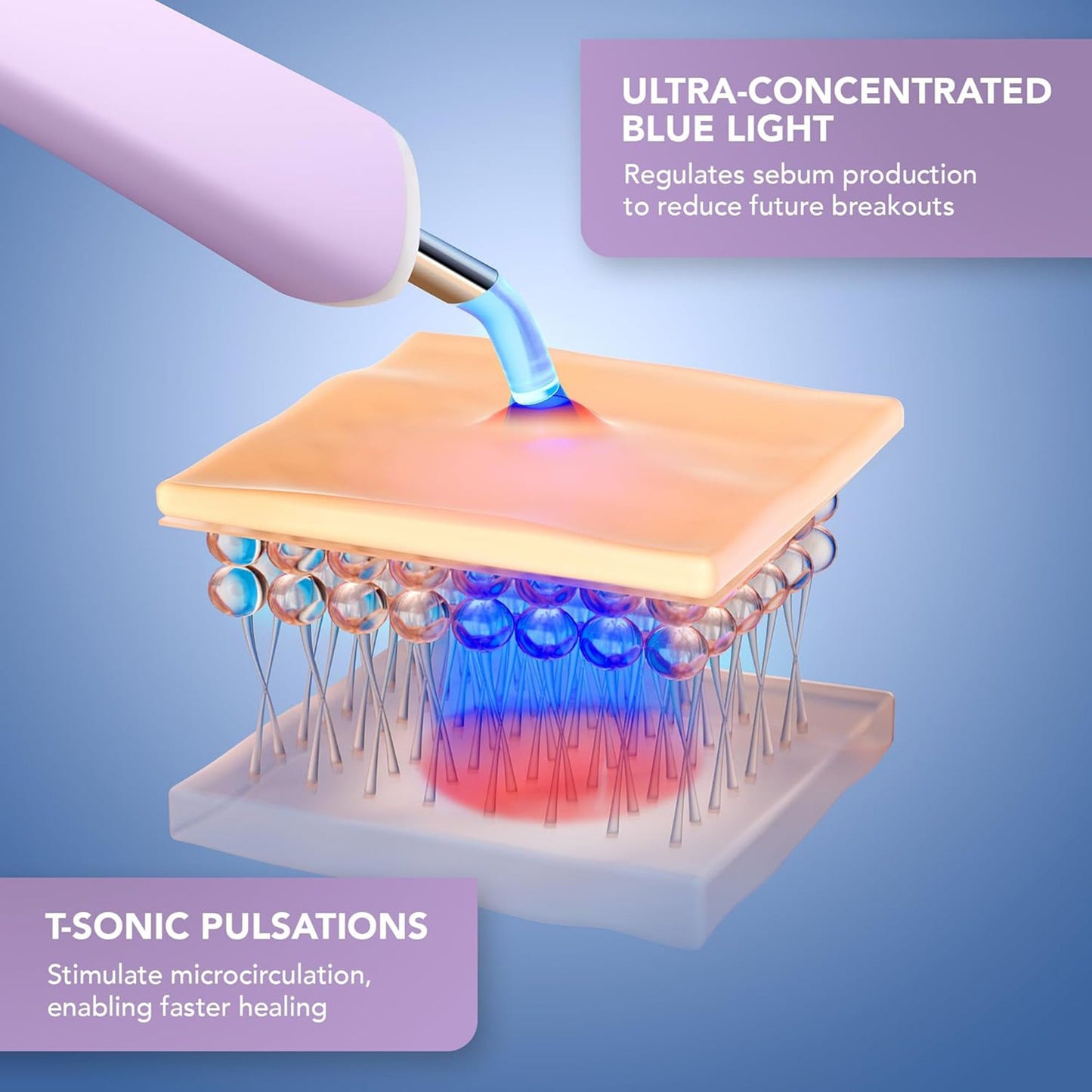 ESPADA™ 2 Plus Acne Therapy Device, Lavender F1757