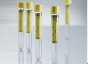 Vacuette® Urinalysis Tube, 6 mL, 13 x 100 mm 456007