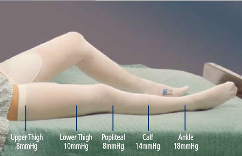 Cardinal T.E.D. Knee High Anti-embolism Stockings, 2X-Large / Regular 7470LF, PR