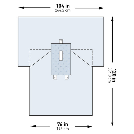 Abdominal Drape McKesson Laparotomy Drape 104 W X 76 W X 120 L Inch Sterile - 183-I80-05170G-S