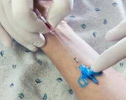 Closed IV Catheter Introcan Safety® 3 20 Gauge 1 Inch Polyurethane Winged Hub Blood Control Passive Safety - 4251129-02