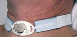 AirLife® Tracheostomy Tube Holder RES242A