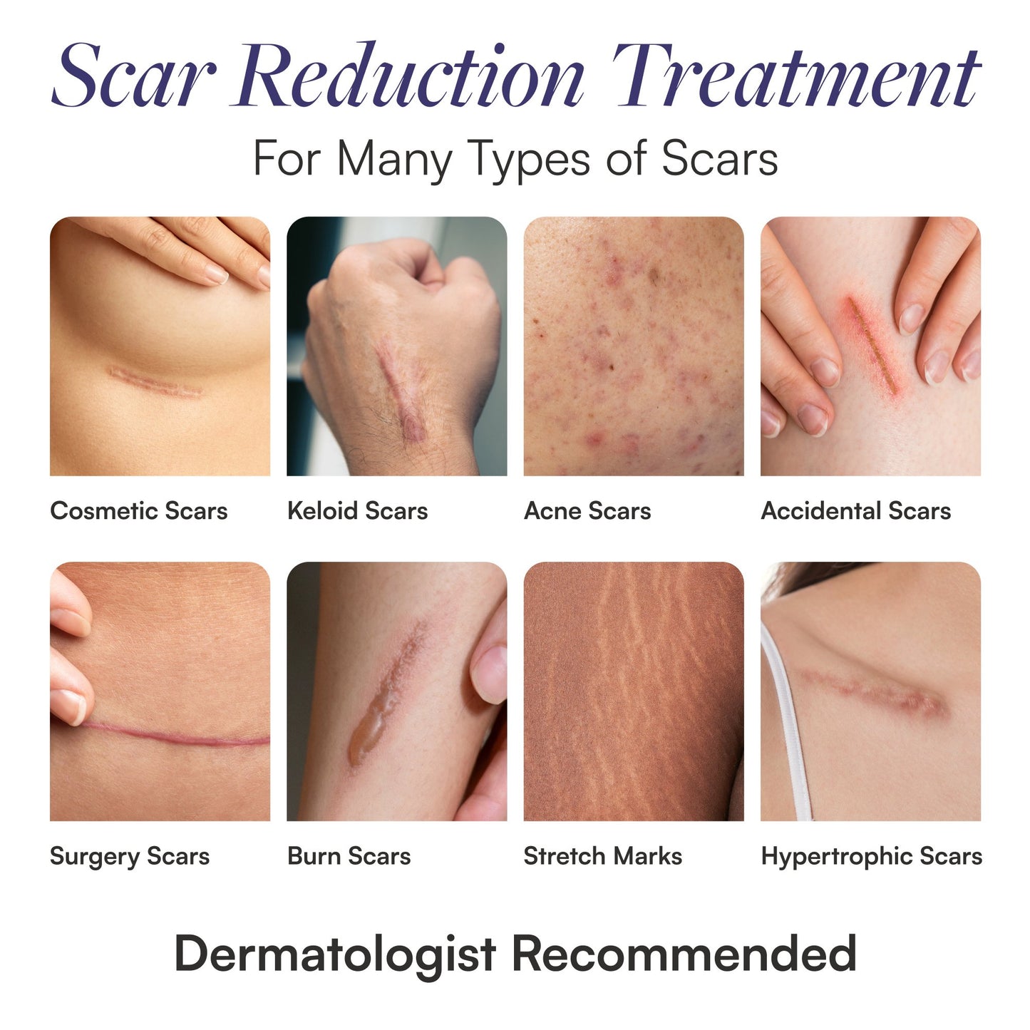 Skintensive® Silicone Scar Sheets SK-0010