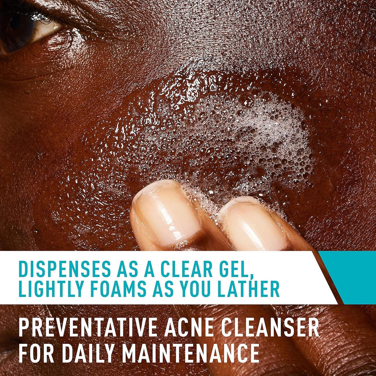 Acne Treatment CeraVe® Acne Control Cleanser 8 oz. Gel 60600057713