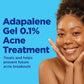 Acne Treatment Differin® 45 Gram Gel 30299492045