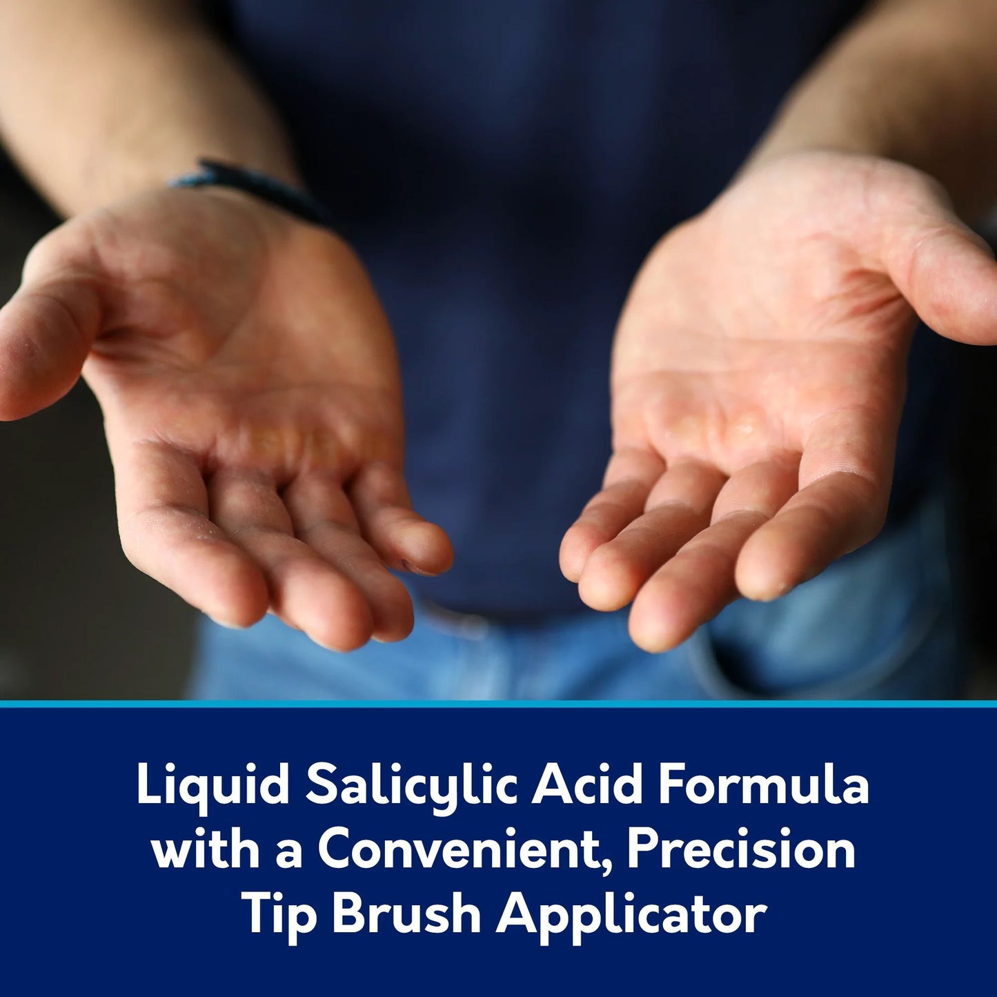 Compound W® Wart Remover 75137059110