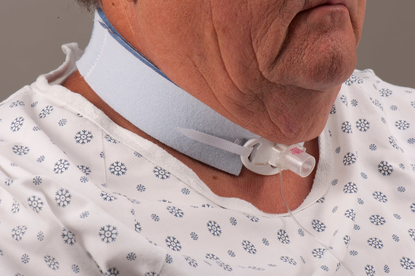 Dale Medical Products Dale Trach Tube Holder 244, 1 Each