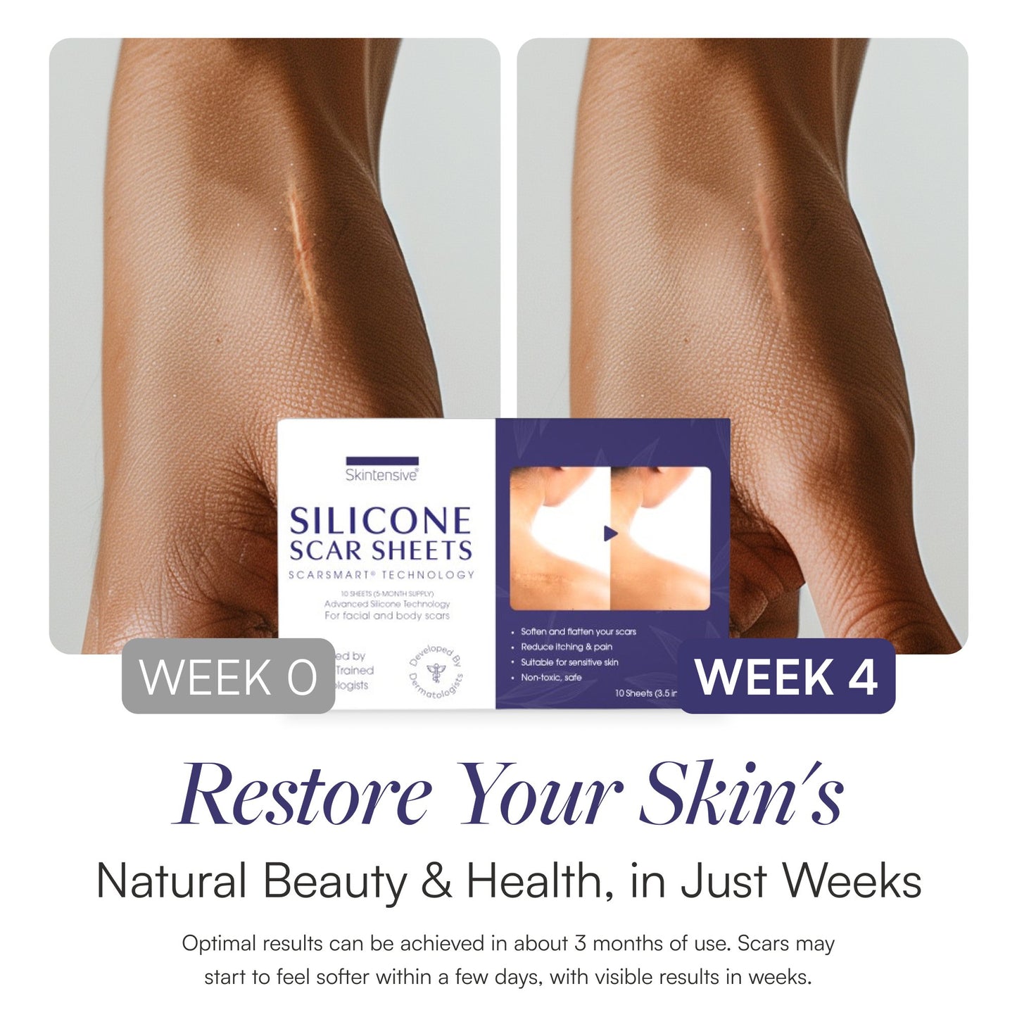 Skintensive® Silicone Scar Sheets SK-0010