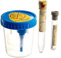 BD Vacutainer® Urine Specimen Collection Kit 364957