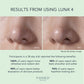 LUNA™ 4 Facial Cleansing Device for Combination Skin F1276