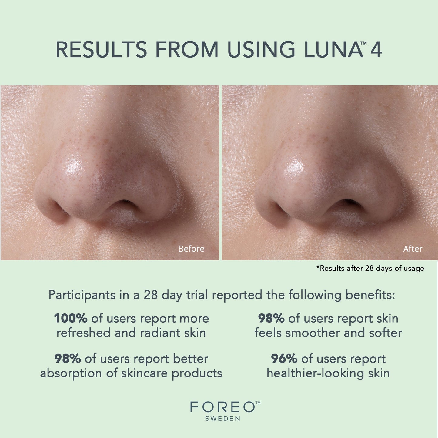 LUNA™ 4 Facial Cleansing Device for Combination Skin F1276