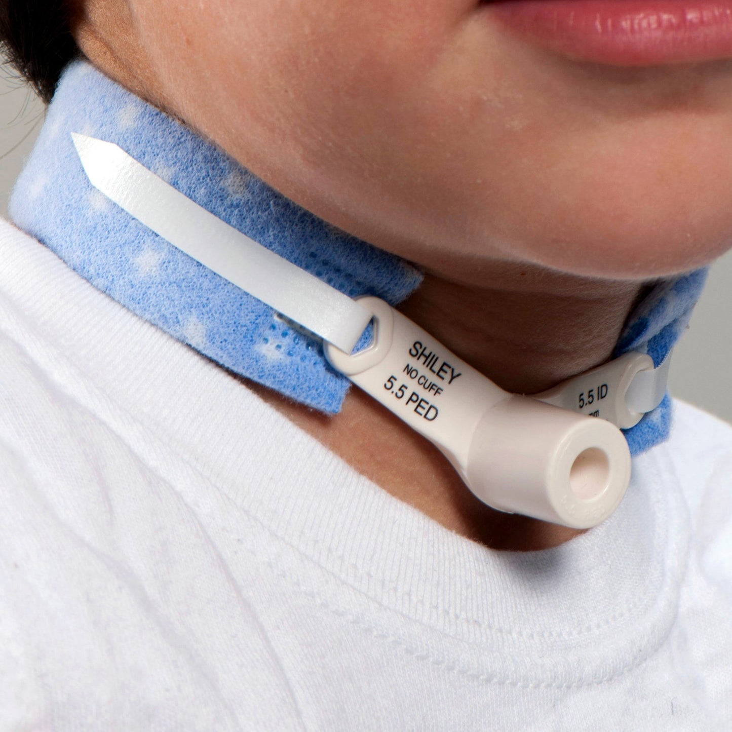 Dale® PediStars™ Tracheostomy Tube Holder 241