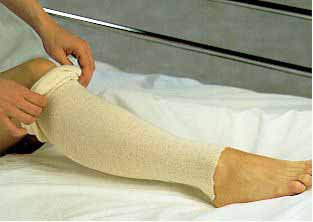 AlbaHealth® Natural Cotton Tubular Stockinette, 3 Inch x 25 Yard 81320