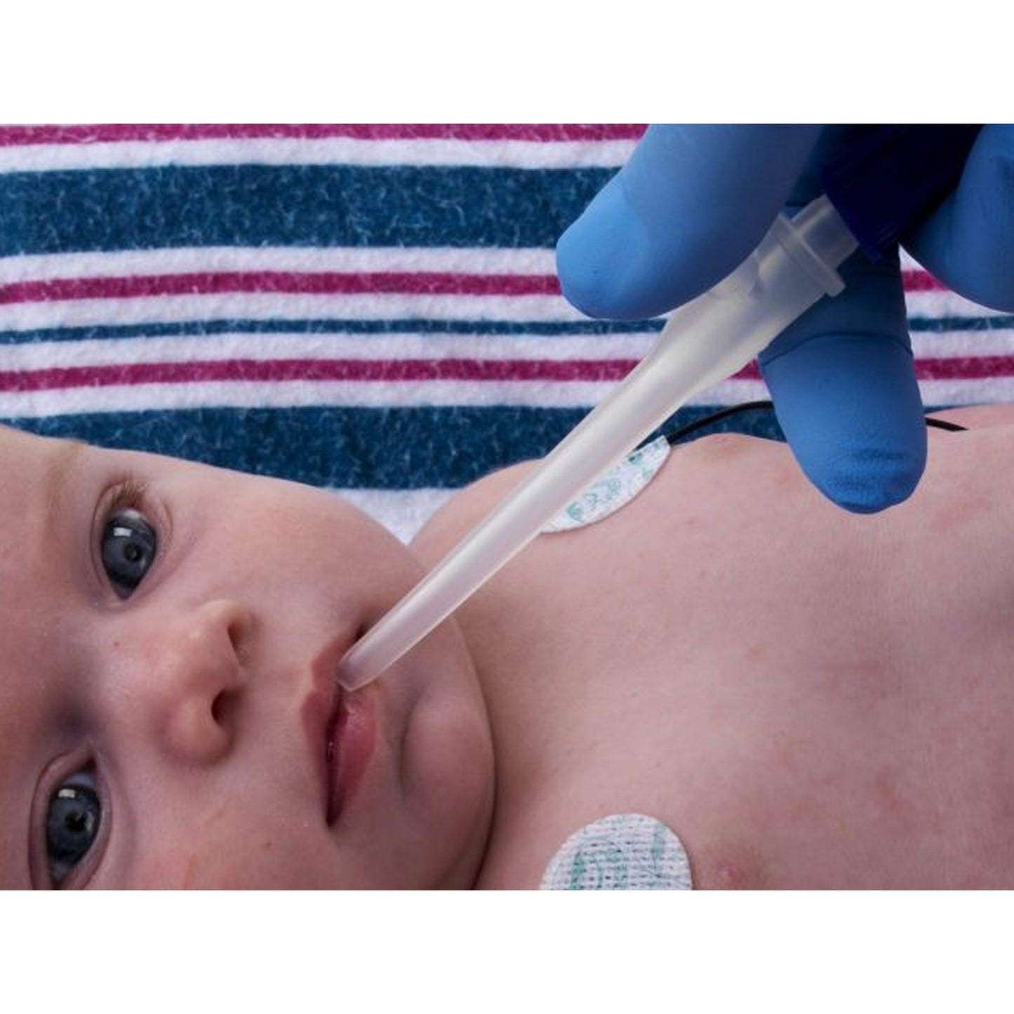 Little Sucker® Standard Style Suction Device, Oral and Nasal Type N205