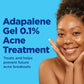 Differin Gel Acne Treatment 00299492030
