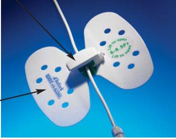 BD Statlock Universal Plus Drainage Catheter Stabilization Device VUPD1416, 1 Each