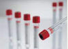 Vacuette® Z Serum Clot Activator Venous Blood Collection Tube, 9 mL, 16 x 100 mm 455092
