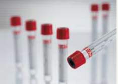 Vacuette® Z Serum Clot Activator Venous Blood Collection Tube, 9 mL, 16 x 100 mm 455092