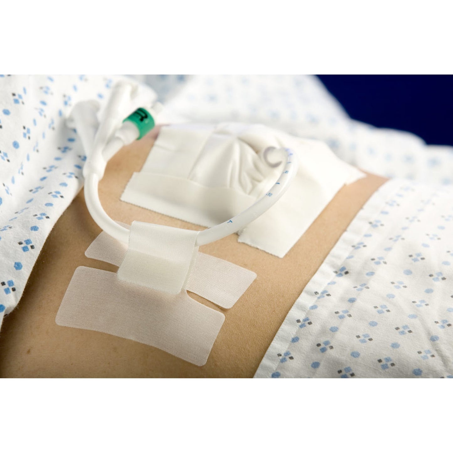 Holder, Tube Cath-Secure™ Single Hook and Loop Tab, Hypoallergenic Tape, Butterfly Design - 5445-2
