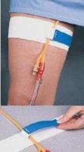 Cath-Mate ® II Leg Stap 08148214