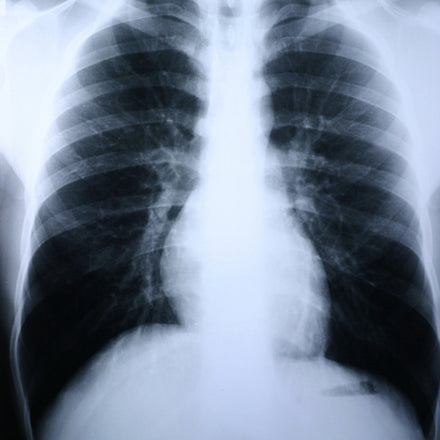 X-Ray Film