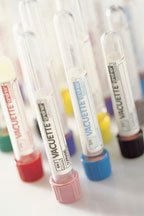 VACUETTE® Venous Blood Collection Tube K2 EDTA Additive 6 mL Pull Cap Polyethylene Terephthalate (PET) Tube - 456002