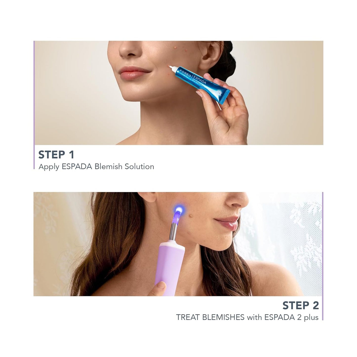 ESPADA™ 2 Plus Acne Therapy Device, Lavender F1757
