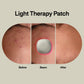 Acne Light Therapy Patch Kit lab ACPOD