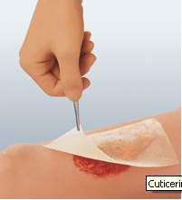 Oil Emulsion Impregnated Dressing Cuticerin Rectangle 3 X 8 Inch Sterile - 66045561