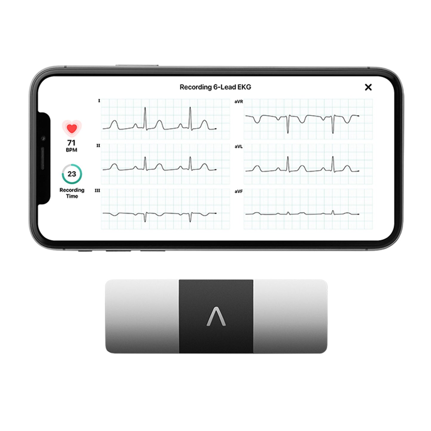 KardiaMobile® 6L Electrocardiograph AC-019-NUA-A