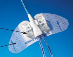 BD Statlock PICC Plus Central Venous Catheter Stabilization Device VPPPSP, 1 Each