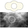 Radiology Skin Marker Spee-D-Ring™ - SDG-M612
