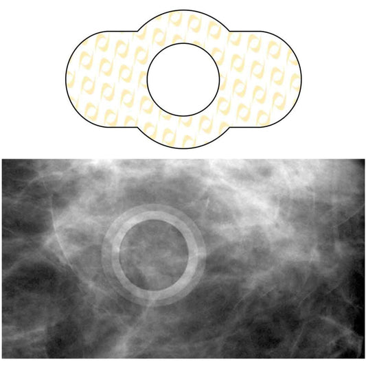 Radiology Skin Marker Spee-D-Ring™ - SDG-M612