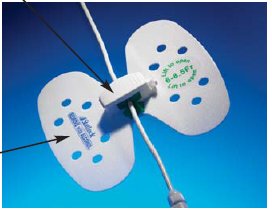 Catheter / Line Securement Device StatLock® Universal Plus - VUPD1214